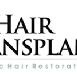 My Hair Transplant Md